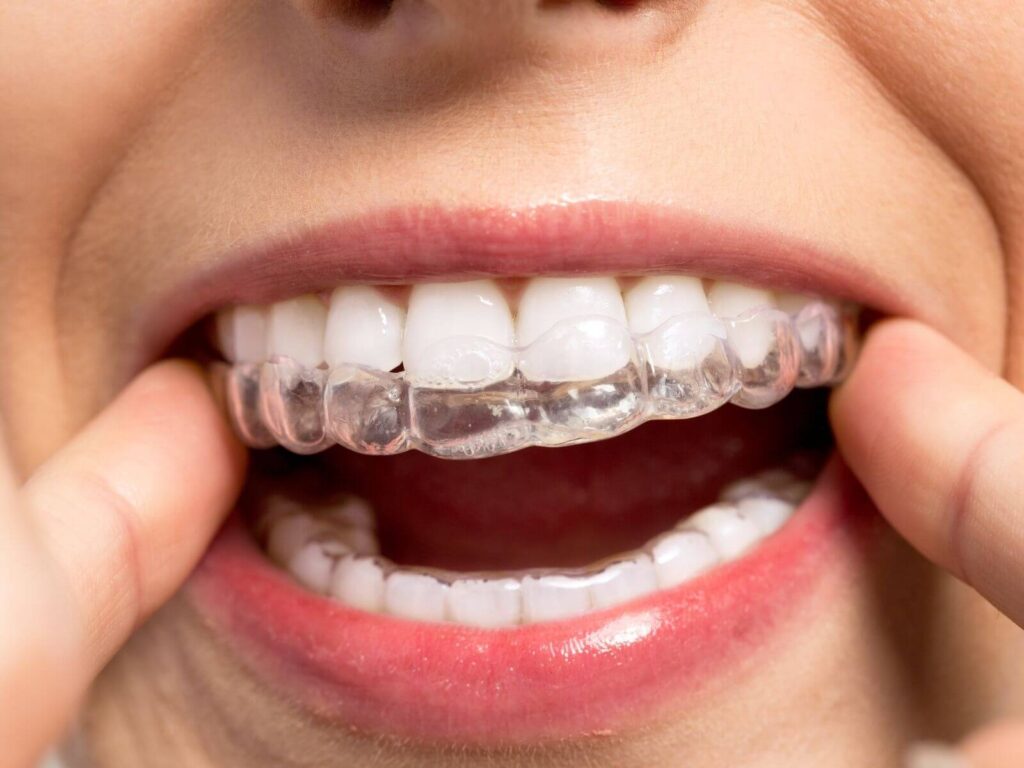 Orthodontic
