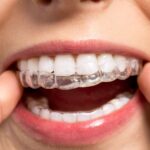 Orthodontic