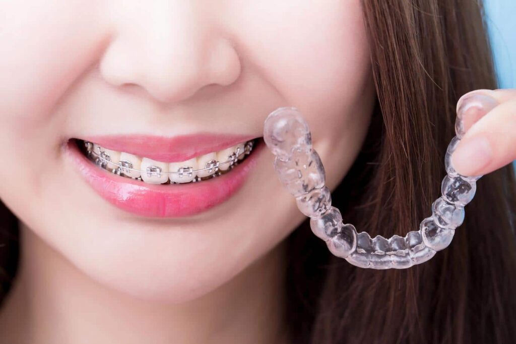 orthodontic