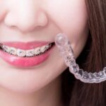 orthodontic